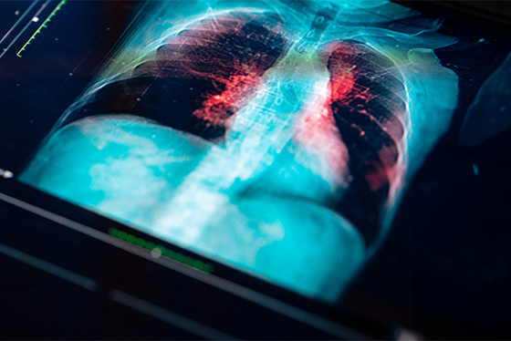 MRI image of human lungs